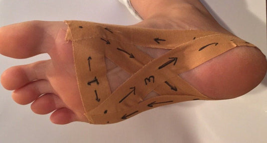 Dry Brushing the Feet and Plantar Fasciitis